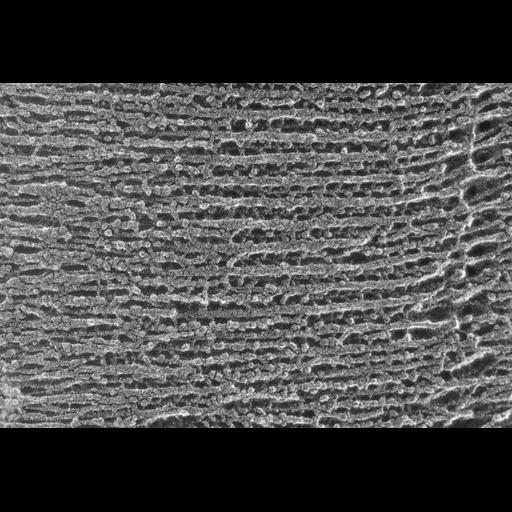skeletal muscle cell
