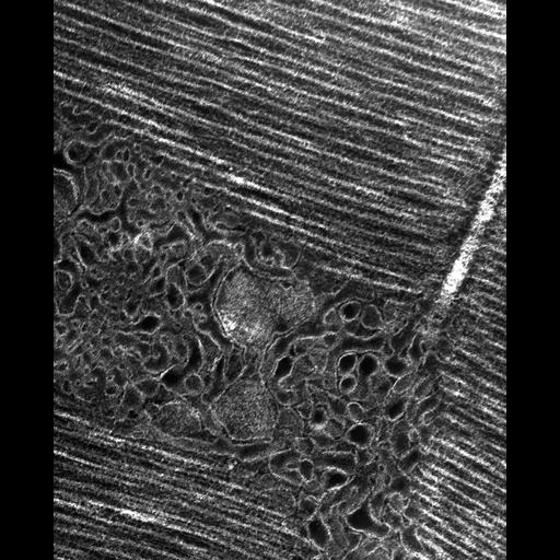 flight muscle cell