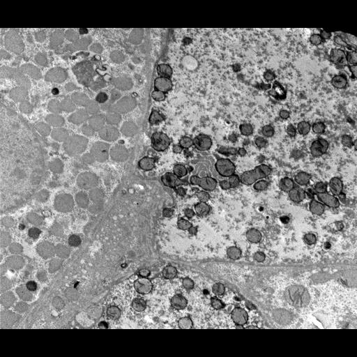 liver parenchymal cell
