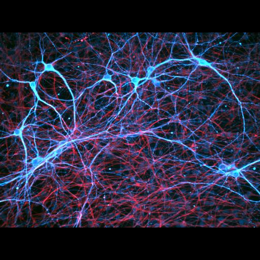 neural stem cell