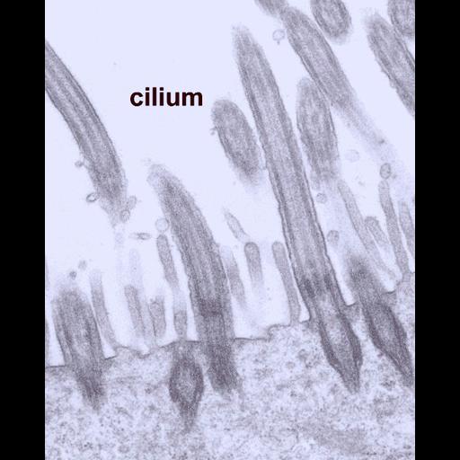 ciliated cell in gastric epithelium of KO mouse